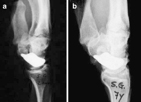 Fig. 10