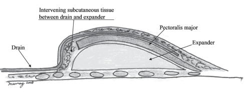 Figure 1)