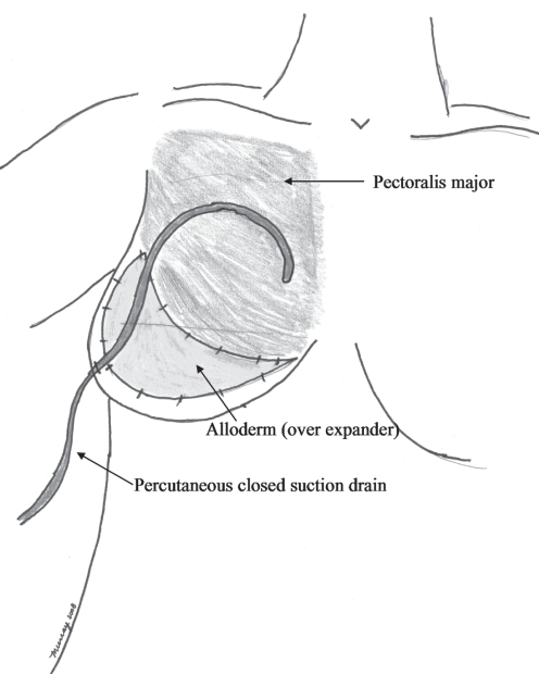 Figure 2)