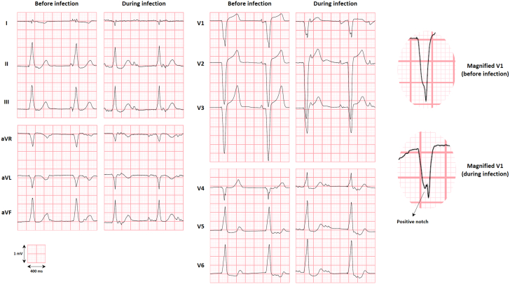 Figure 2