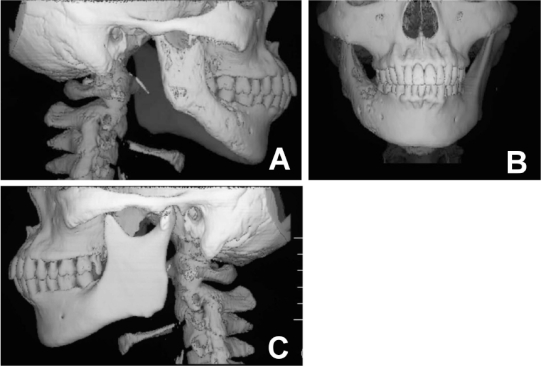 Fig. (5)