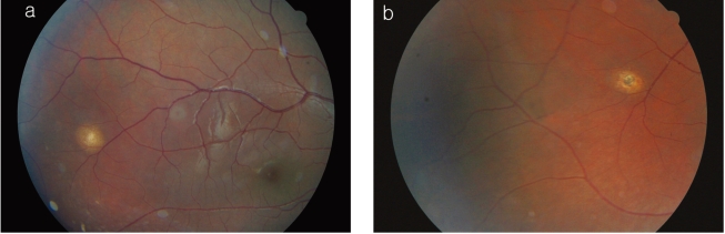 Fig. 3