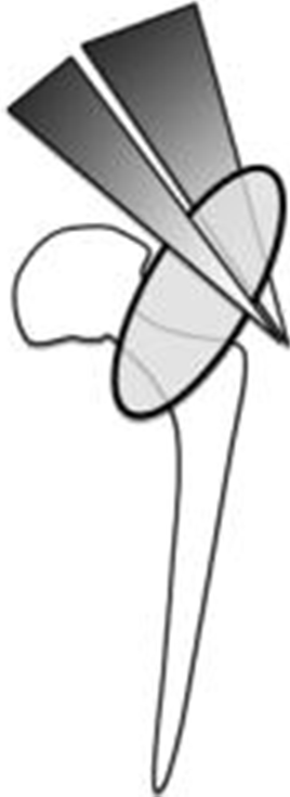 graphic file with name 11420_2013_9357_Figb_HTML.gif