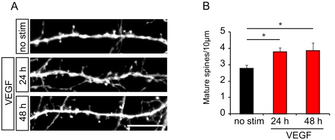 Figure 2—figure supplement 1.