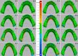 Fig 10