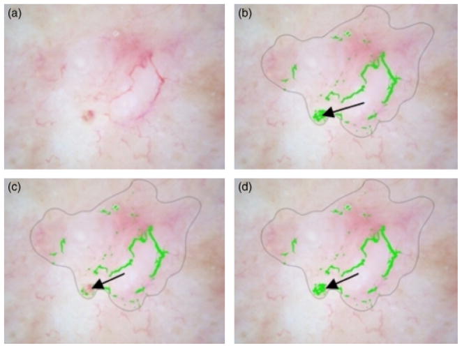 Fig. 9