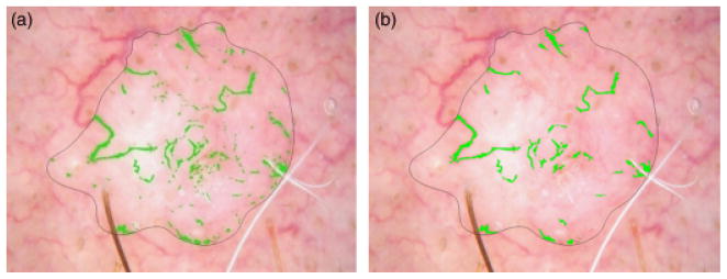 Fig. 11