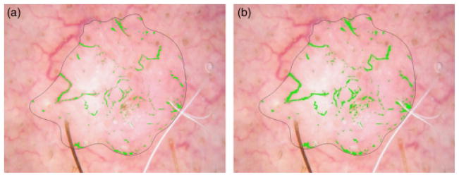 Fig. 10