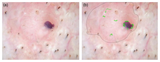 Fig. 13