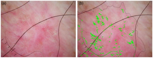 Fig. 14