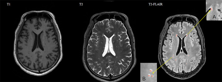 Fig. 1