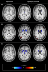 Fig. 1
