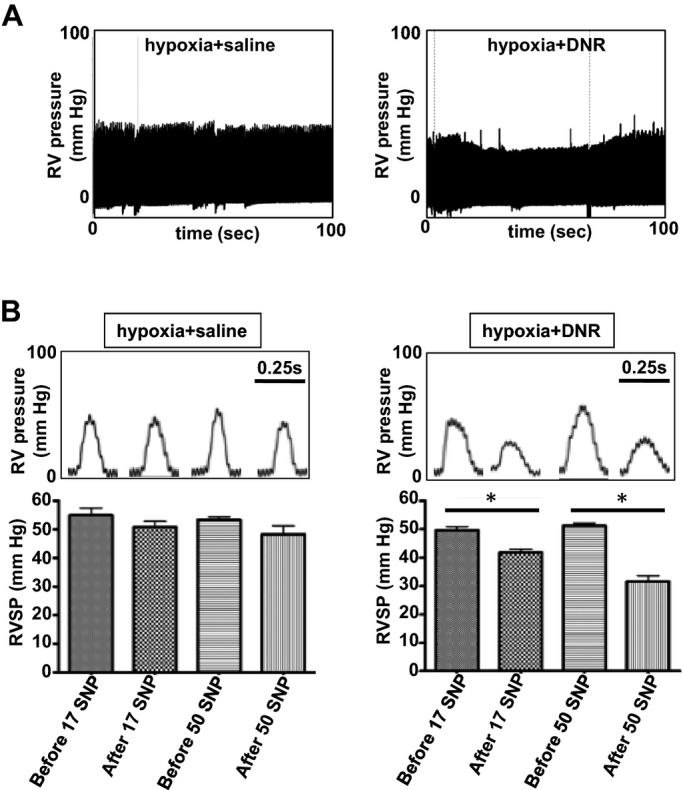 Figure 12.