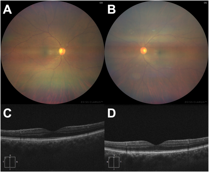 Fig. 2