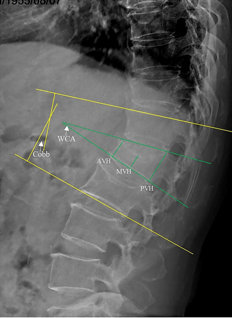 Figure 3