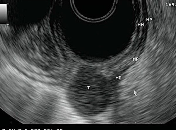 Fig. 13