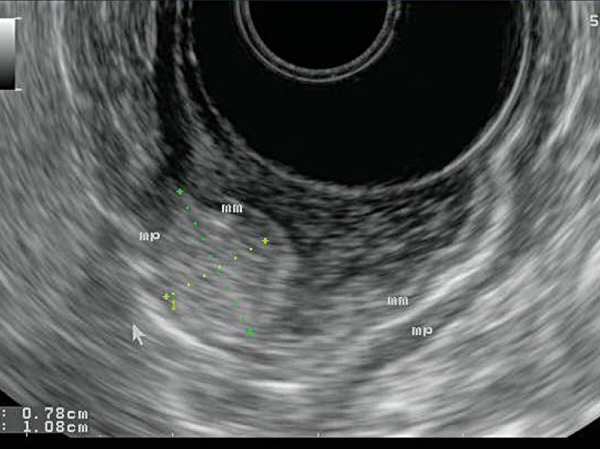 Fig. 14