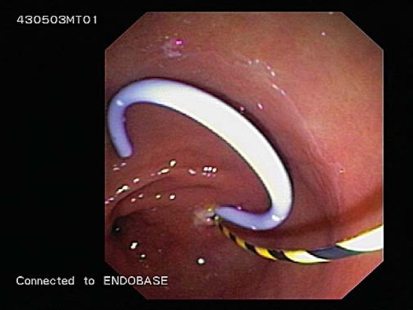 Fig. 18