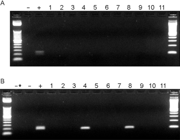 Presence of Leishmania RNA virus 1 in clinical samples. Representative
nested retro-transcription polymerase chain reaction (PCR) ethidium bromide
stained 2.5% agarose gel. Ladders are 50 bp (left) and 100 bp (right). A:
first round PCR using pair 1 primers; B: second and nested round using pair
2 primers; -: negative control; +: positive control with Leishmania (V.)
guyanensis (MHOM/BR/1989/IM3597) cDNA; -*: double negative control using
first round negative control as template; Lanes 1-3: state of Rio de Janeiro
(RJ)-recidivant localised cutaneous leishmaniasis; 4, 8, 9: state of
Amazonas-localised cutaneous leishmaniasis (LCL); 5-7: RJ-LCL; 10: RJ-scar;
11: RJ-mucosal leishmaniasis.