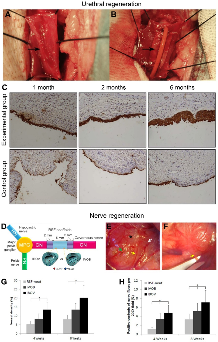 Fig. 11