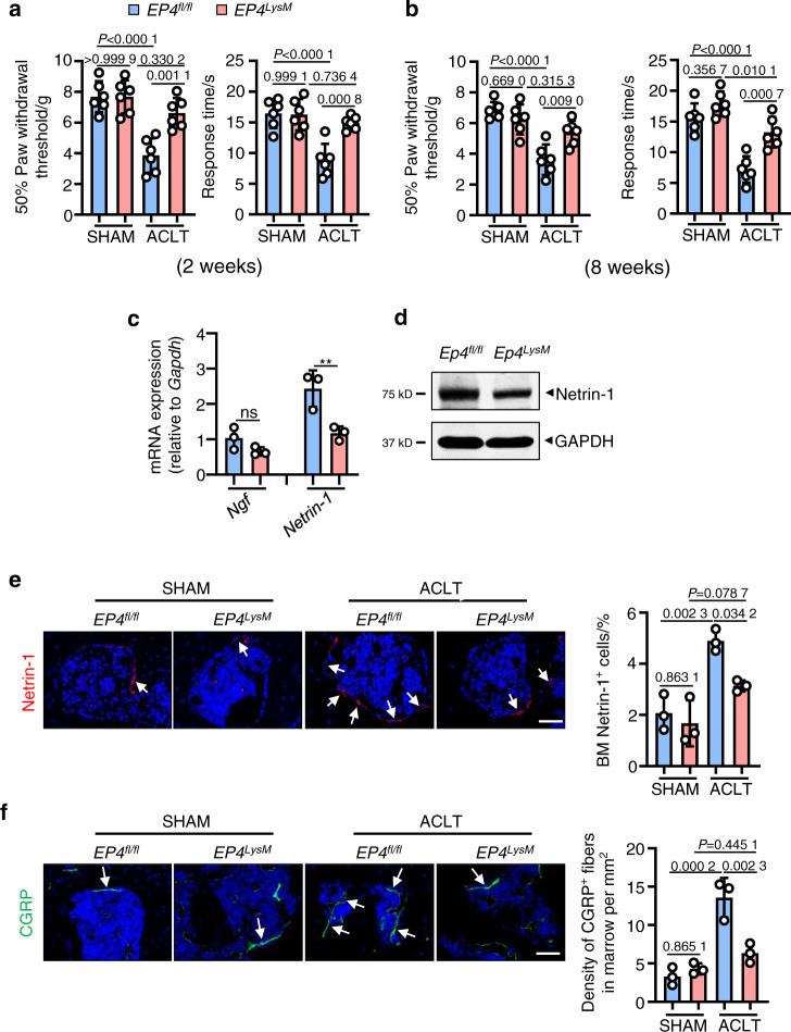 PGE2 activates EP4 in subchondral bone osteoclasts to regulate ...