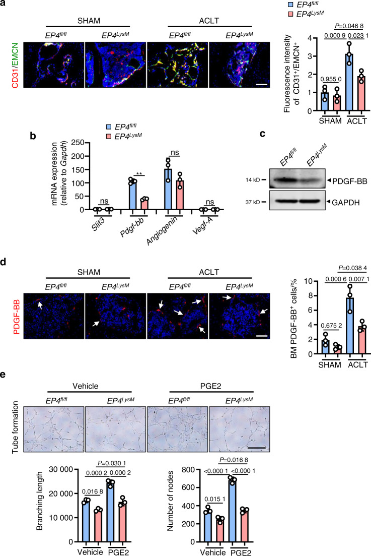 PGE2 activates EP4 in subchondral bone osteoclasts to regulate ...