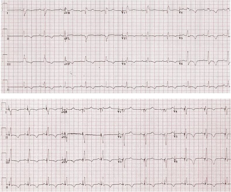 Fig. 2