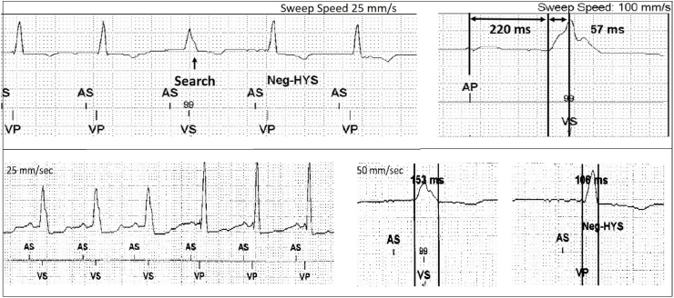 Fig. 4