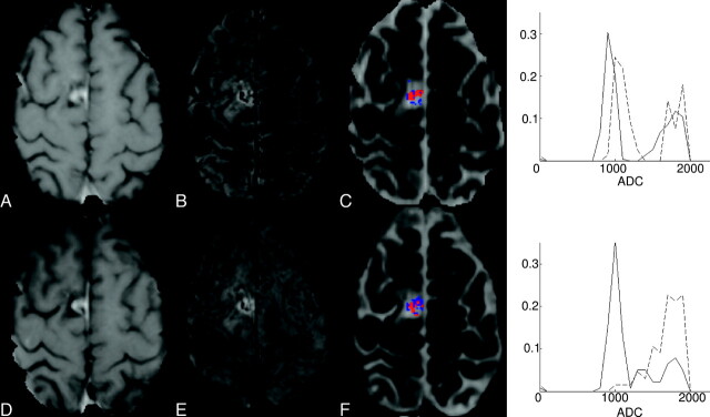 Fig 3.