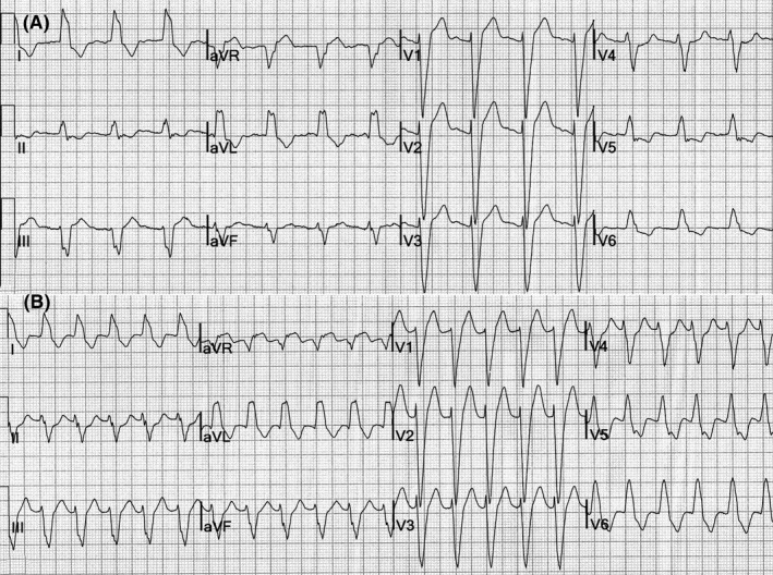 FIGURE 2