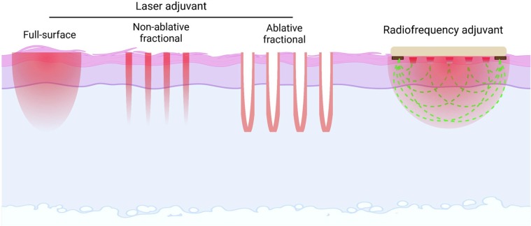 Fig. 4