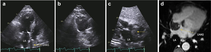 Figure 21