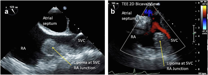 Figure 19