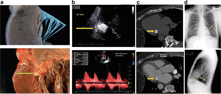 Figure 22