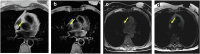 Figure 20