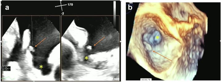 Figure 4