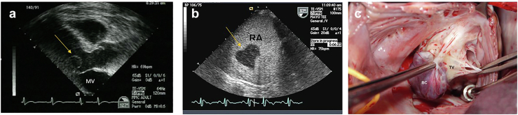 Figure 12