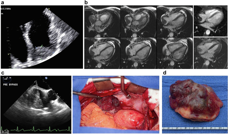 Figure 24