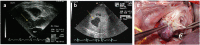 Figure 12