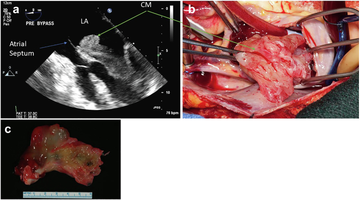 Figure 15