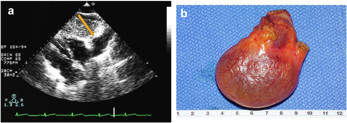 Figure 23