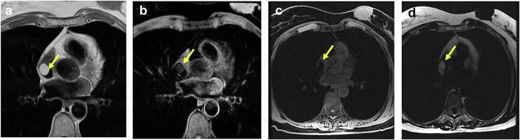 Figure 20