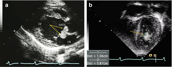 Figure 17