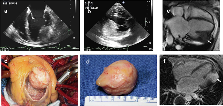 Figure 18