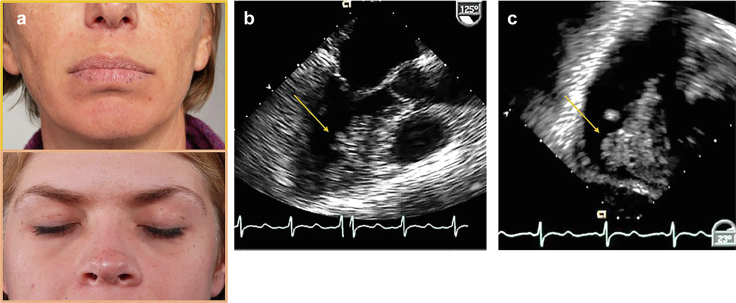 Figure 14