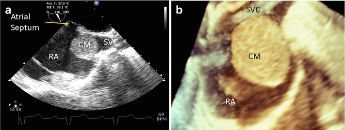 Figure 16