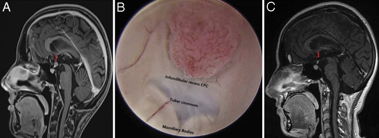 FIG. 3.