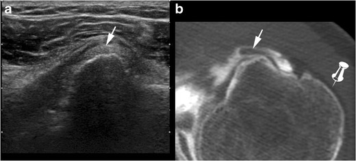 Fig. 12