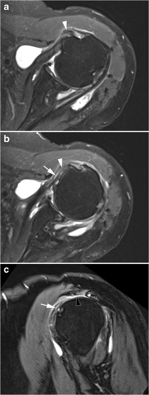 Fig. 11