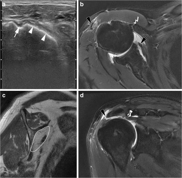 Fig. 13